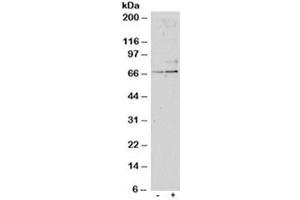Western blot testing of untreated (left) and TGFBI-treated (right, 1ng/ml, 24hr) primary cultured human lung fibroblasts with SRF antibody at 1ug/ml. (SRF antibody)