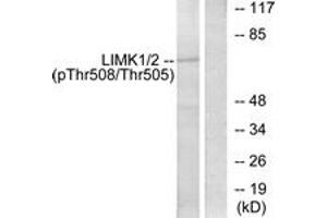 Western blot analysis of extracts from COLO205 cells, using LIMK1 (Phospho-Thr508) Antibody.