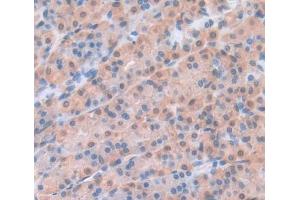 #VALUE! (BCAT2 antibody  (AA 218-393))