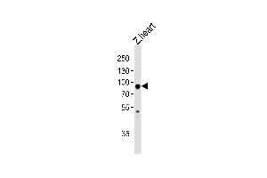 Western Blotting (WB) image for anti-Heat Shock Protein 90kDa alpha (Cytosolic), Class A Member 1 (HSP90AA1) (AA 229-263) antibody (ABIN1945096)