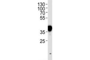 NPM1 antibody western blot analysis in HeLa lysate. (NPM1 antibody  (AA 7-33))