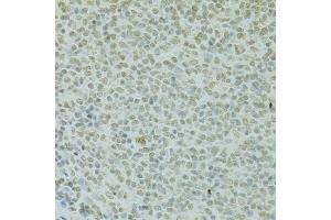 Immunohistochemistry of paraffin-embedded rat spleen using RCC1 antibody (ABIN5973761) at dilution of 1/100 (40x lens). (RCC1 antibody)