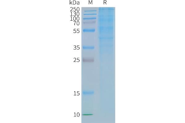 GLP1R Protein