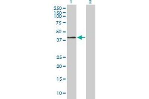 Western Blot analysis of CTSH expression in transfected 293T cell line by CTSH MaxPab polyclonal antibody.