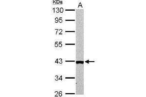 WB Image Arginase II antibody detects ARG2 protein by Western blot analysis. (ARG2 antibody  (Center))
