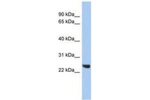 Image no. 1 for anti-Proteasome (Prosome, Macropain) Subunit, beta Type 2 (PSMB2) (C-Term) antibody (ABIN6744081) (PSMB2 antibody  (C-Term))