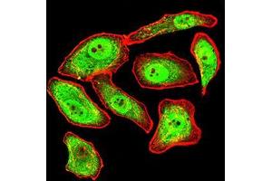 Immunocytochemistry (ICC) image for anti-Synapsin I (SYN1) (AA 362-511) antibody (ABIN5542390)