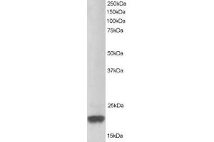 Image no. 1 for anti-Parkinson Protein 7 (PARK7) (C-Term) antibody (ABIN374310) (PARK7/DJ1 antibody  (C-Term))