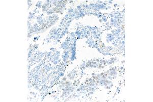 Immunohistochemistry (IHC) image for anti-SRY (Sex Determining Region Y)-Box 2 (SOX2) antibody (ABIN7449421) (SOX2 antibody)