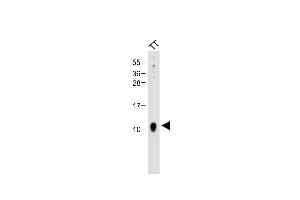 Anti-CALCA Antibody (Center) at 1:2000 dilution + TT whole cell lysate Lysates/proteins at 20 μg per lane. (CGRP antibody  (AA 56-83))