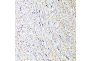 Immunohistochemistry of paraffin-embedded mouse heart using RCN2 antibody (ABIN5975169) at dilution of 1/100 (40x lens).