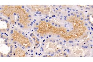 Detection of ERK1 in Human Kidney Tissue using Monoclonal Antibody to Extracellular Signal Regulated Kinase 1 (ERK1) (ERK1 antibody  (AA 75-312))