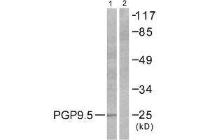 Western Blotting (WB) image for anti-Ubiquitin Carboxyl-terminal Esterase L1 (Ubiquitin Thiolesterase) (UCHL1) (C-Term) antibody (ABIN1848742) (UCHL1 antibody  (C-Term))