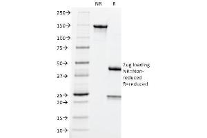 SDS-PAGE Analysis Purified CEA Mouse Monoclonal Antibody (CEA31). (CEACAM5 antibody)