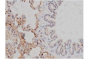 ABIN6267331 at 1/200 staining Rat lung tissue sections by IHC-P. (LYN antibody  (pTyr507))