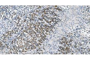 IHC analysis of DRP1/DNM1L using anti-DRP1/DNM1L antibody (ABIN7602180).