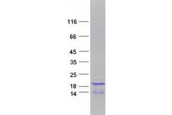 HIST1H2BH Protein (Myc-DYKDDDDK Tag)