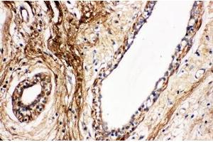 IHC analysis of Protein C using anti- Protein C antibody . (PROC antibody  (C-Term))