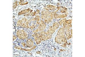 IHC analysis of BUB1B using anti-BUB1B antibody (ABIN7600962).