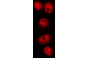 ABIN6268985 staining HuvEc by IF/ICC. (HNRNPD/AUF1 antibody  (pSer83))