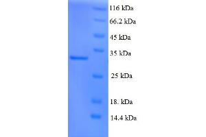 SDS-PAGE (SDS) image for Xeroderma Pigmentosum, Complementation Group C (XPC) (AA 496-734) protein (His tag) (ABIN5710632)