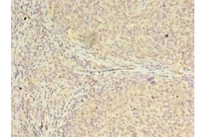 Immunohistochemistry of paraffin-embedded human tonsil tissue using ABIN7147697 at dilution of 1:100 (CBX2 antibody  (AA 1-211))