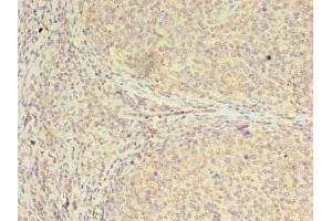 Immunohistochemistry of paraffin-embedded human tonsil tissue using ABIN7147697 at dilution of 1:100 (CBX2 antibody  (AA 1-211))