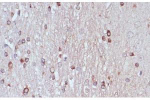 Immunohistochemistry of paraffin-embedded Rat brain using TPD52 Polyclonal Antibody at dilution of 1:100 (40x lens). (TPD52 antibody)