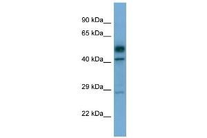 Western Blotting (WB) image for anti-serine/threonine Kinase 17a (STK17A) (C-Term) antibody (ABIN2787865) (STK17A antibody  (C-Term))