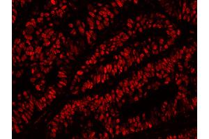 Immunofluorescence (IF) image for anti-Minichromosome Maintenance Complex Component 2 (MCM2) (AA 1-50) antibody (ABIN7448987)