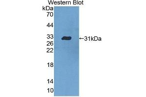 Detection of Recombinant CASP10, Human using Polyclonal Antibody to Caspase 10 (CASP10) (Caspase 10 antibody  (AA 223-459))