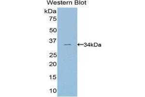 Western Blotting (WB) image for anti-Suppressor of Variegation 4-20 Homolog 2 (SUV420H2) (AA 2-279) antibody (ABIN1078551) (SUV420H2/KMT5C antibody  (AA 2-279))