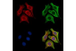 ABIN6257428 and ABIN6275868 staining H2O2 treated Hela cells by IF/ICC.