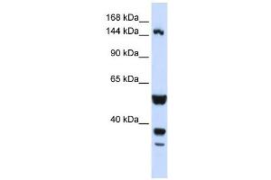 ABI3BP antibody used at 1 ug/ml to detect target protein. (ABI3BP antibody)