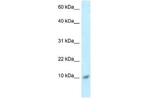 Western Blot showing S100A8 antibody used at a concentration of 1 ug/ml against ACHN Cell Lysate (S100A8 antibody  (Middle Region))