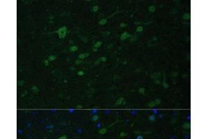Immunofluorescence analysis of Mouse brain using KMT2E Polyclonal Antibody at dilution of 1:100. (MLL5/KMT2E antibody)