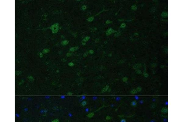 MLL5/KMT2E antibody