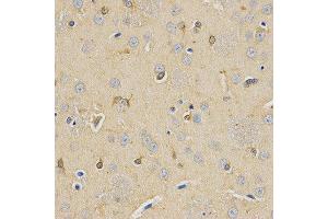 Immunohistochemistry (IHC) image for anti-Carboxypeptidase E (CPE) antibody (ABIN1876646) (CPE antibody)