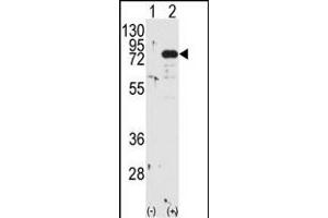 Western blot analysis of PRKCB (arrow) using PKC beta1/2 Antibody (Center) (ABIN391002 and ABIN2841178). (PKC beta1/2 (AA 303-334) antibody)