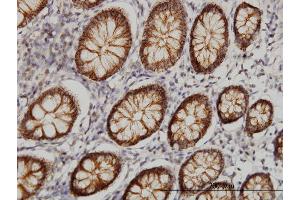 Immunostaining (ISt) image for anti-Claudin 1 (CLDN1) (AA 1-211) antibody (ABIN563931)