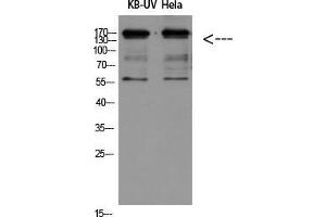 Western Blot (WB) analysis of KB-UV HeLa using Integrin beta2 Polyclonal Antibody diluted at 1:500. (Integrin beta 2 antibody  (Internal Region))