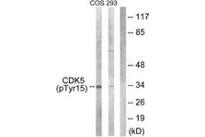 Western blot analysis of extracts from COS7 cells treated with EGF 200ng/ml 30' and 293 cells treated with H2O2 100u, 15mins, using CDK5 (Phospho-Tyr15) Antibody. (CDK5 antibody  (pTyr15))