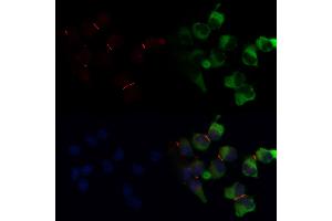 ABIN6266146 and ABIN6268691 staining  by IF/ICC. (TJP1 antibody  (Internal Region))