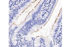 Immunohistochemistry analysis of paraffin-embedded rat duodenum using,SLC22A1 (ABIN7075663) at dilution of 1: 1200 (SLC22A1 antibody)