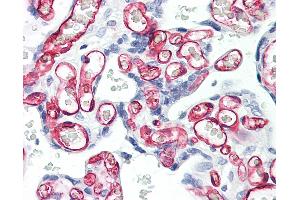 Anti-CD34 antibody IHC of human placenta. (CD34 antibody)