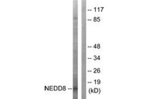 Western blot analysis of extracts from Jurkat cells, using NEDD8 Antibody. (NEDD8 antibody  (AA 10-59))