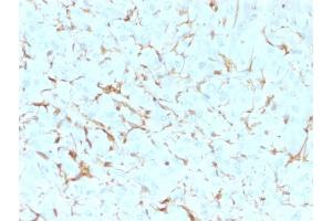 Formalin-fixed, paraffin-embedded human Adrenal Gland stained with NGFR Mouse Monoclonal Antibody (NGFR5). (NGFR antibody)