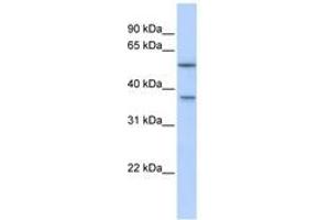 Image no. 1 for anti-RAB40B, Member RAS Oncogene Family (RAB40B) (AA 144-193) antibody (ABIN6741128) (RAB40B antibody  (AA 144-193))