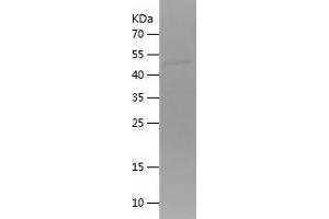 Western Blotting (WB) image for Hepatocyte Growth Factor (Hepapoietin A, Scatter Factor) (HGF) (AA 496-728) protein (His-IF2DI Tag) (ABIN7123306) (HGF Protein (AA 496-728) (His-IF2DI Tag))