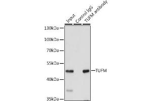 Immunoprecipitation analysis of 200 μg extracts of 293T cells, using 3 μg TUFM antibody (ABIN6127865, ABIN6149701, ABIN6149702 and ABIN6222063).